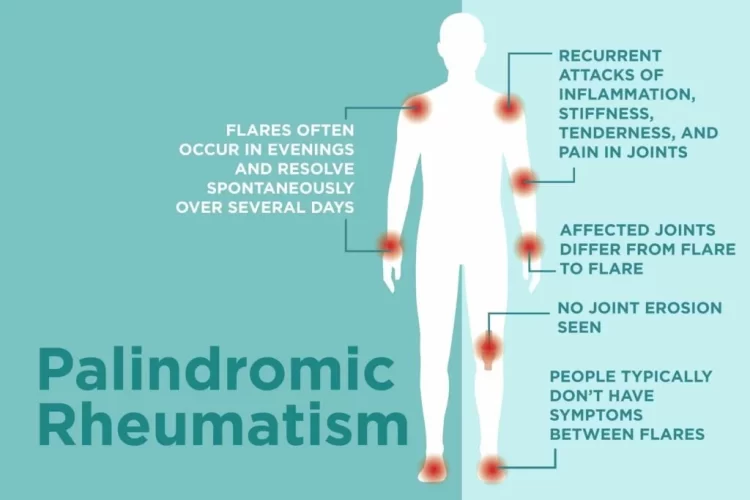 0119 Palindromic Rheumatism 1024x683 1 scaled